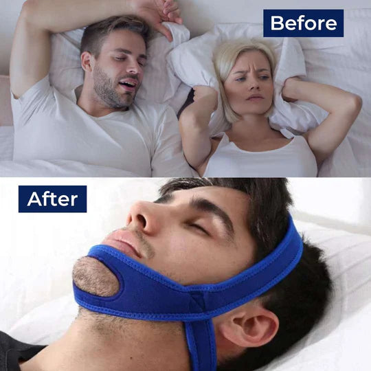 Full Head Chin Strap for Snoring and Sleep Apnea Support, Comfortable Night Use