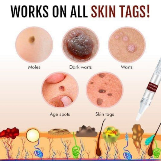 Tags and Moles Remover Tool