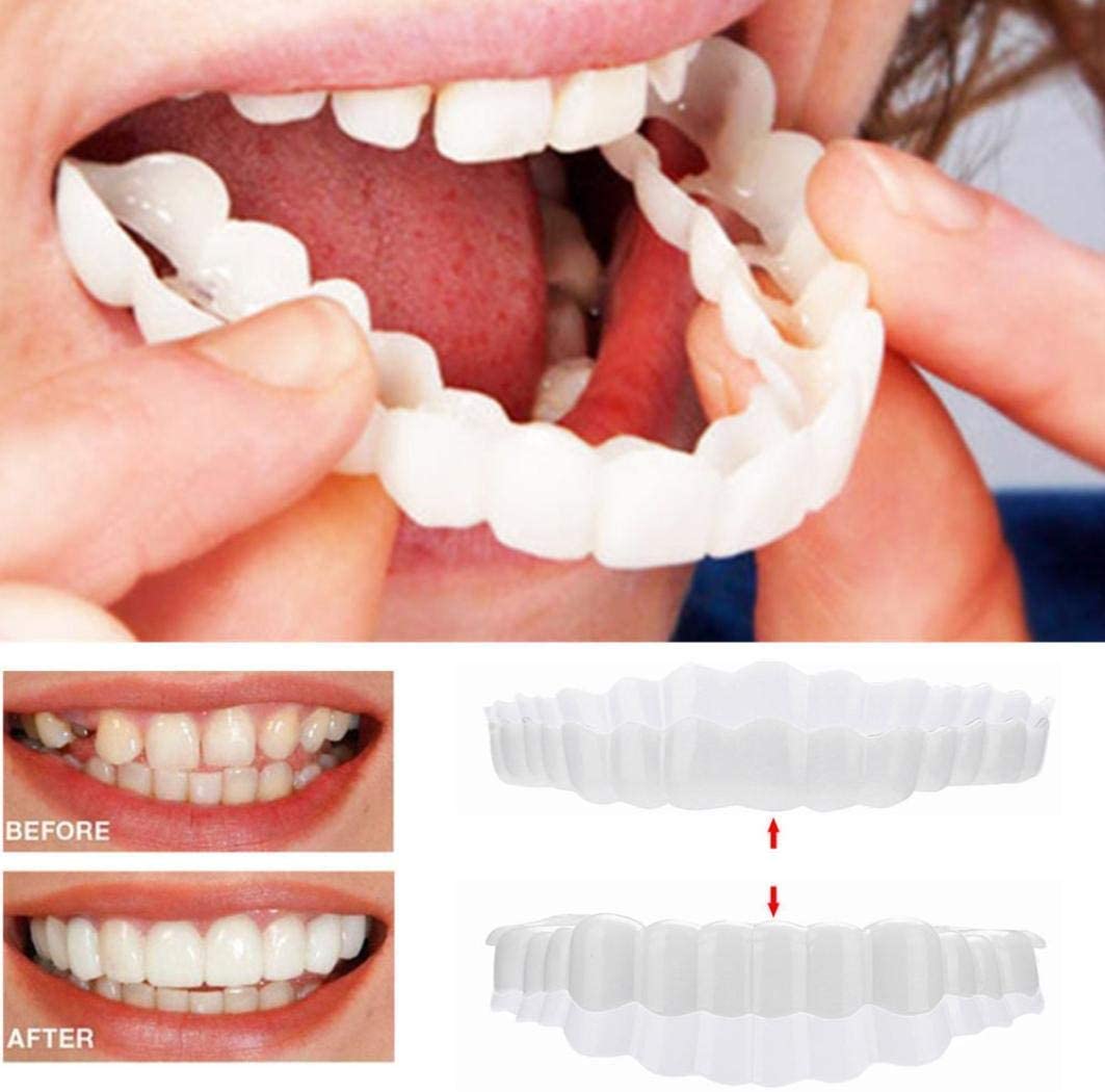 Smile Veneer Set for Upper and Lower Teeth
