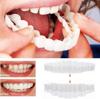 Smile Veneer Set for Upper and Lower Teeth