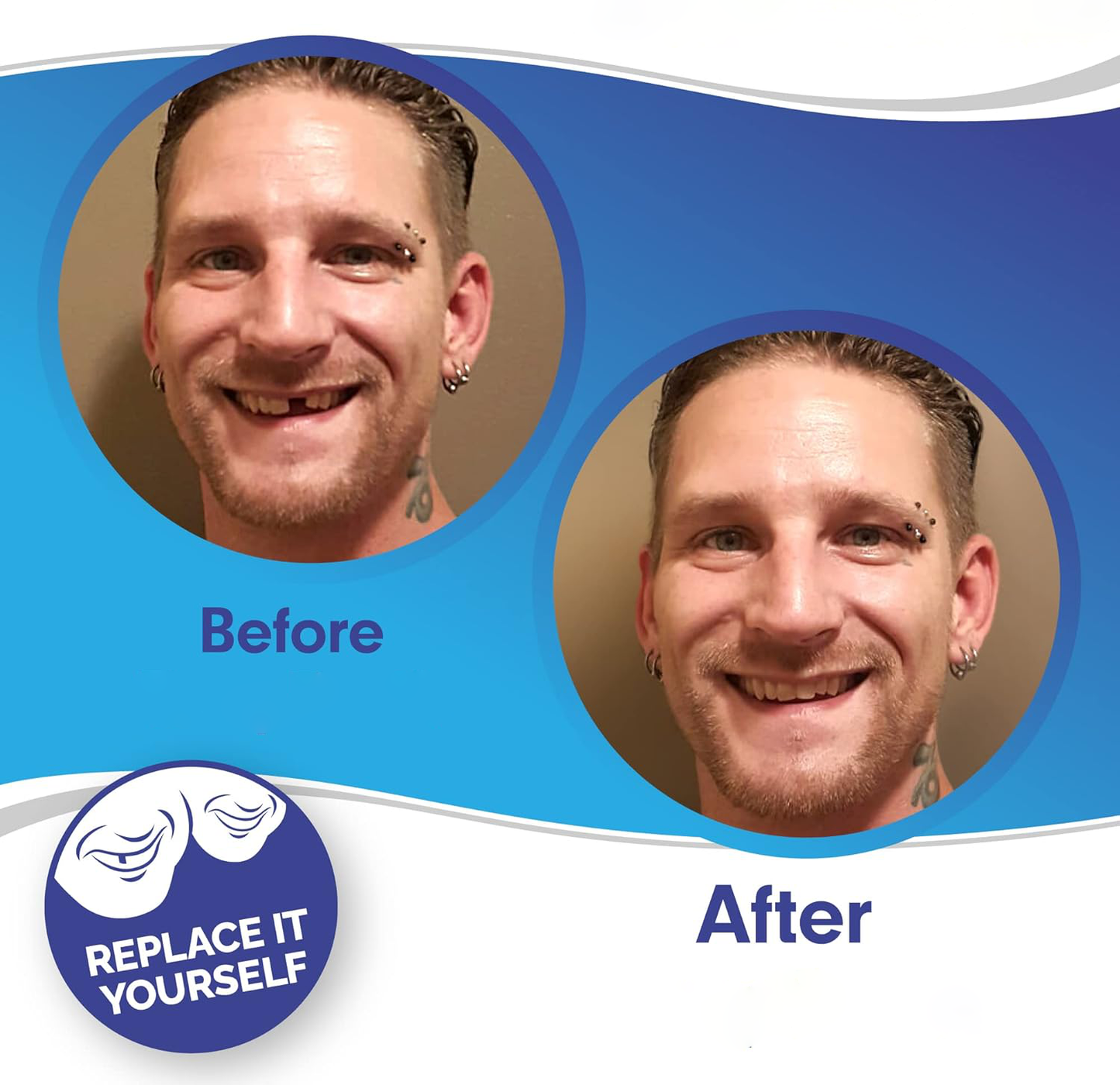 Smile Veneer Set for Upper and Lower Teeth