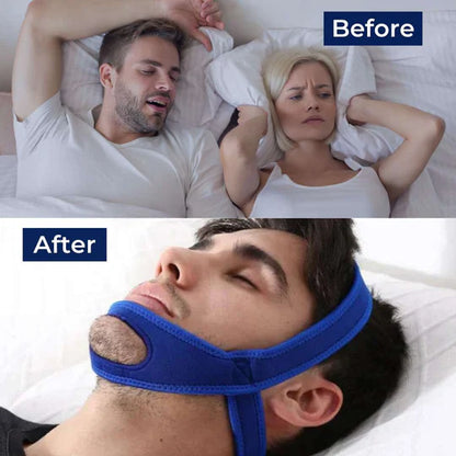 Full Head Chin Strap for Snoring and Sleep Apnea Support, Comfortable Night Use