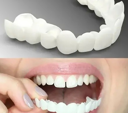 Adjustable Snap-On Dentures for Comfortable Fit