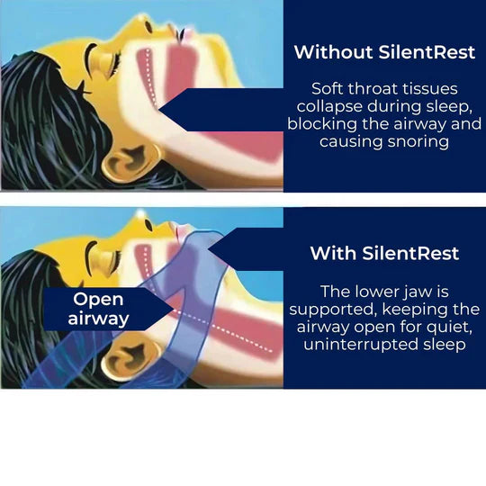 Full Head Chin Strap for Snoring and Sleep Apnea Support, Comfortable Night Use