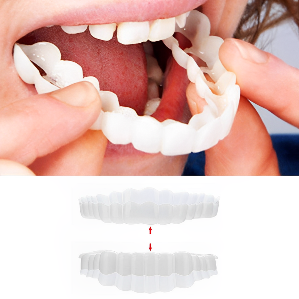 Smile Veneer Set for Upper and Lower Teeth