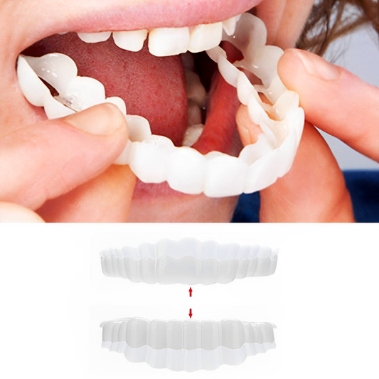 Smile Veneer Set for Upper and Lower Teeth