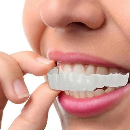 Smile Veneer (Upper & Lower Included)