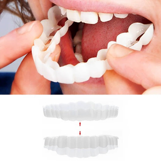 Smile Veneer (Upper & Lower Included)
