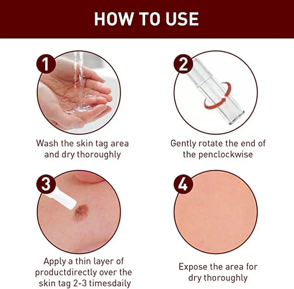 Tags and Moles Remover Tool