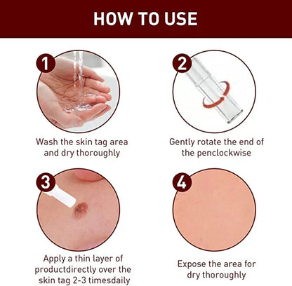 Tags and Moles Remover Tool