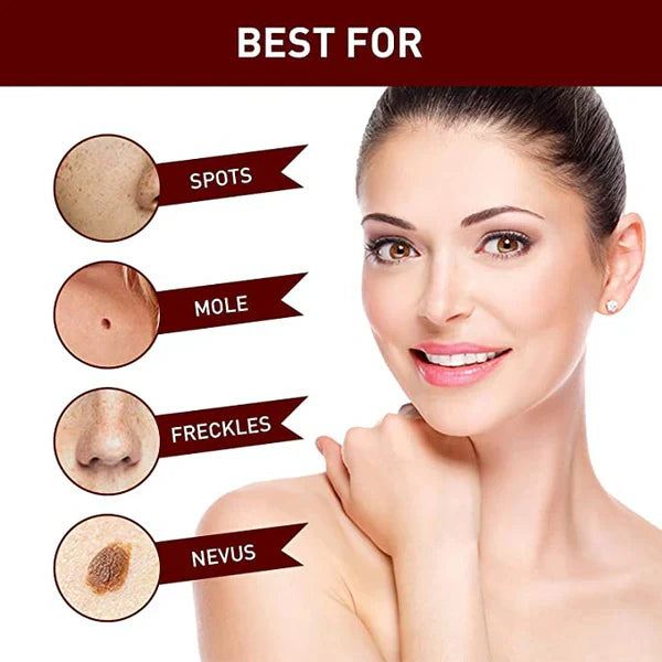 Tags and Moles Remover Tool