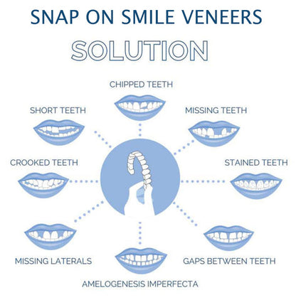 Smile Veneer Set for Upper and Lower Teeth